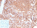 IHC staining of FFPE human tonsil tissue with recombinant CD45RA antibody (clone PTPRC/7019R). Negative control inset: PBS instead of primary antibody to control for secondary binding. HIER: boil tissue sections in pH 9 10mM Tris with 1mM EDTA for 20 min and allow to cool before testing.
