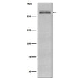Western blot testing of human HepG2 cell lysate with Fibronectin antibody. Predicted molecular weight ~220 kDa (monomer) but may be observed at a higher molecular weight due to glycosylation.