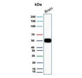 Western blot testing of human brain tissue with GFAP antibody. Predicted molecular weight ~50 kDa.