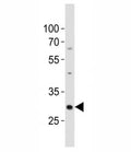 Western blot analysis of lysate from mouse kidney tissue lysate using Hes1 antibody diluted at 1:500. Predicted molecular weight: 30-35 kDa.