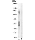 Western blot testing of human prostate lysate with ADAM33 antibody at 0.3ug/ml with [B] and without [A] immunizing peptide. Predicted molecular weight: ~88kDa but bands from 22-38kDa may also be visualized.