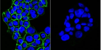 Left: Immunofluorescent staining of human A431 cells with CF488-conjugated EGFR antibody (clone GFR450, green) and DAPI nuclear stain (blue). Right: isotype control.