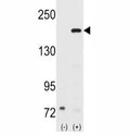 Western blot analysis of SRC-1 antibody and 293 cell lysate (2 ug/lane) either nontransfected (Lane 1) or transiently transfected with the NCOA1 gene (2).