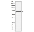 Western blot testing of human HepG2 cell lysate with AFP antibody. Predicted molecular weight ~70 kDa.