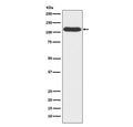 Western blot testing of human A549 cell lysate with OGT antibody. Predicted molecular weight: 110-117 kDa.