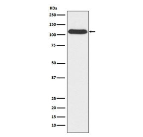 Western blot testing of human A549 cell lysate with OGT antibody. Predicted molecular weight: 110-117 kDa.