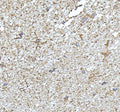 Western blot testing of NDRG2 antibody and Lane 1: SMMC-7721; 2: PANC lysate. Expected/observed molecular weight ~41kDa.