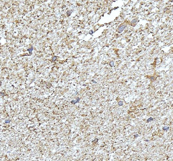 Western blot testing of NDRG2 antibody and Lane 1: SMMC-7721; 2: PANC lysate. Expected/observed molecular weight ~41kDa.