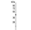 Western blot testing of human MDA-MB-231 cell lysate with PRB2 antibody. Predicted molecular weight ~41 kDa.