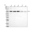 Western blot analysis of INAVA using anti-INAVA antibody. Lane 1: human Hacat whole cell lysates, Lane 2: human whole cell lysates, Lane 3: human whole cell lysates, Lane 4: human Caco-2 whole cell lysates, Lane 5: human RT4 whole cell lysates. After electrophoresis, proteins were transferred to a nitrocellulose membrane at 150 mA for 50-90 min. Blocked the membrane with 5% non-fat milk/TBS for 1.5 hour at RT.