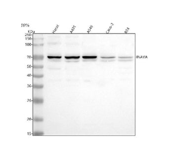 Western blot analysis of INAVA using anti-INAVA antibody. Lane 1: human Hacat whole cell lysates, Lane 2: human whole cell lysates, Lane 3: human whole cell lysates, Lane 4: human Caco-2 whole cell lysates, Lane 5: human RT4 whole cell lysates. After electrophoresis, proteins were transferred to a nitrocellulose membrane at 150 mA for 50-90 min. Blocked the membrane with 5% non-fat milk/TBS for 1.5 hour at RT.