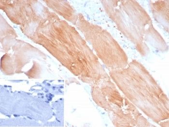 IHC staining of FFPE human skeletal muscle tissue with ACTN2 antibody (clone ACTN2/8184R). Inset: PBS used in place of primary Ab (secondary Ab negative control). HIER: boil tissue sections in pH 9 10mM Tris with 1mM EDTA for 20 min and allow to cool before testing.