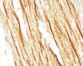 IHC staining of FFPE human colon tissue with recombinant Smoothelin antibody (clone SMTN/2320R). HIER: boil tissue sections in pH6, 10mM citrate buffer, for 20 min and allow to cool before testing.
