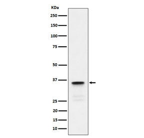Western blot testing of human testis tissue lysate with LDHC antibody. Predicted molecular weight ~36 kDa.