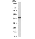 Western blot testing of human platelet lysate with VASP antibody at 0.01ug/ml. Expected molecular weight: ~40/46-50 kDa (unmodified/phosphorylated).