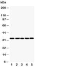 Western blot testing of E2F6 antibody and Lane 1: HeLa; 2: COLO320; 3: A549; 4: MCF-7; 5: SMMC-7721 cell lysate. Predicted molecular weight: ~32kDa.