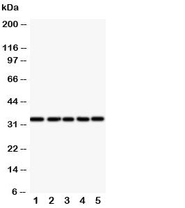 Western blot testing of E2F6 antibody and Lane 1: HeLa; 2: COLO320; 3: A549; 4: MCF-7; 5: SMMC-7721 cell lysate. Predicted molecular weight: ~32kDa.