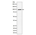 Western blot testing of human MCF7 cell lysate with RSK2 antibody. Predicted molecular weight ~84 kDa, commonly observed at 84-90 kDa.