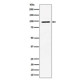 Western blot testing of human MCF7 cell lysate with RSK2 antibody. Predicted molecular weight ~84 kDa, commonly observed at 84-90 kDa.