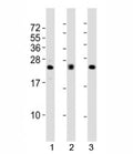 Western blot testing of FGF2 antibody at 1:2000 dilution; Lane 1: human A549 lysate, 2: mouse heart lysate; 3: rat lung lysate. Predicted molecular weight: 17-31 kDa (multiple isoforms).