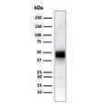 Western blot testing of human Jurkat cell lysate with recombinant CD5 antibody (clone rC5/6429). Observed molecular weight: 55~67 kDa depending on glycosylation level.