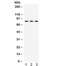 Western blot testing of 1) rat brain, 2) mouse brain, 3) U87 lysate with PAK5 antibody. Expected/observed molecular weight ~81 kDa.