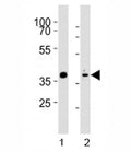 Western blot analysis of lysate from mouse stomach, rat heart tissue (left to right) using Mouse Nkx2.5 antibody at 1:1000 for each lane. Predicted molecular weight ~35 kDa, routinely observed at 35~45 kDa.