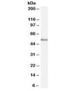Western blot testing of human tonsil lysate with WIPF1 antibody at 0.03ug/ml. Commonly observed molecular weight: 50-55 kDa with a possible ~36 kDa isoform.