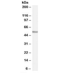 Western blot testing of human tonsil lysate with WIPF1 antibody at 0.03ug/ml. Commonly observed molecular weight: 50-55 kDa with a possible ~36 kDa isoform.