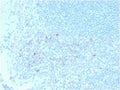 IHC testing of FFPE human tonsil tissue with CD25 antibody (clone IL2RA/2395). HIER: boil tissue sections in pH6, 10mM citrate buffer, for 10-20 min followed by cooling at RT for 20 min.