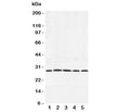 Western blot testing of Adiponectin antibody and rat samples 1: testis; 2: spleen; 3: skeletal muscle; 4: heart; 5: liver lysate. Routinely observed at 26~30kDa.