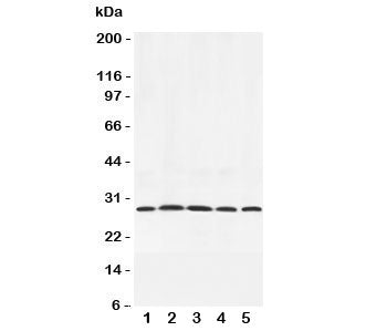 Western blot testing of Adiponectin antibody and rat samples 1: testis; 2: spleen; 3: skeletal muscle; 4: heart; 5: liver lysate. Routinely observed at 26~30kDa.