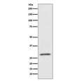 Western blot testing of HUVEC cell lysate with CD99 antibody. Predicted molecular weight: 16-32 kDa depending on the level of glycosylation.
