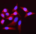 Immunofluorescent staining of FFPE human HeLa cells with Atherin antibody (red) and DAPI nuclear stain (blue). HIER: steam section in pH6 citrate buffer for 20 min.
