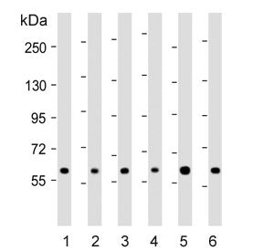 Western blot testing of human 1) 293T, 2) CCRF-CEM, 3) HeLa, 4) Jurkat, 5) MDA-MB-453 and 6) MCF7 cell lysate with RNF31 antibody. Predicted molecular weight ~120 kDa (isoform 1), ~58 kDa (isoform 2) and ~102 kDa (isoform 3).