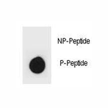Dot blot analysis of phospho-IKK beta antibody. 50ng of phos-peptide or nonphos-peptide per dot were spotted.