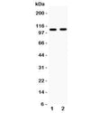 Western blot testing of Nod1 antibody and Lane 1: human A549; 2: rat heart lysate. Predicted/observed molecular weight: ~107 kDa.