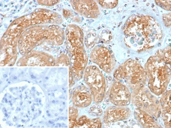 IHC staining of FFPE human kidney tissue with Myxovirus resistance protein 1 antibody (clone MX1/7530). Inset: PBS used in place of primary Ab (secondary Ab negative control). HIER: boil tissue sections in pH 9 10mM Tris with 1mM EDTA for 20 min and allow to cool before testing.