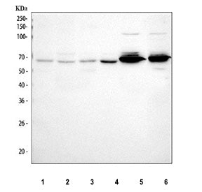 Western blot testing of human 1) SW620 and 2) MCF7 cell lysate with PTGER4 antibody at 0.5ug/ml. Predicted molecular weight ~53 kDa.