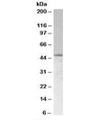 Western blot testing of Jurkat lysate with SAMSN1 antibody at 1ug/ml. Predicted molecular weight: ~49kDa (isoform 3, UniProt# Q9NSI8).