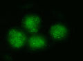 Immunofluorescent staining of FFPE human PC-3 cells with BRD4 antibody (green). HIER: steam section in pH6 citrate buffer for 20 min.