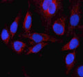 Immunofluorescent staining of FFPE human HeLa cells with GLUD1 antibody (red) and DAPI nuclear stain (blue). HIER: steam section in pH6 citrate buffer for 20 min.