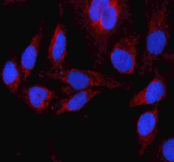Immunofluorescent staining of FFPE human HeLa cells with GLUD1 antibody (red) and DAPI nuclear stain (blue). HIER: steam section in pH6 citrate buffer for 20 min.