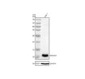 Western blot analysis of NDUFA1 using anti-NDUFA1 antibody. Lane 1: human Hela whole cell lysates, Lane 2: human MCF-7 whole cell lysates, Lane 3: rat kidney tissue lysates, Lane 4: rat liver tissue lysates, Lane 5: rat heart tissue lysates, Lane 6: mouse kidney tissue lysates, Lane 7: mouse liver tissue lysates, Lane 8: mouse heart tissue lysates. After electrophoresis, proteins were transferred to a nitrocellulose membrane at 150 mA for 50-90 min.