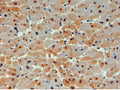 IHC testing of FFPE human heart with UBE2O antibody at 4ug/ml. HIER: steamed with pH6 citrate buffer, HRP-staining.