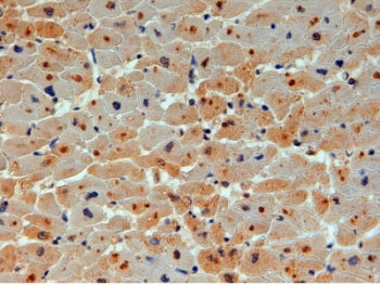 IHC testing of FFPE human heart with UBE2O antibody at 4ug/ml. HIER: steamed with pH6 citrate buffer, HRP-staining.