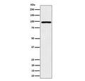 Western blot testing of human HepG2 cell lysate with AKAP8 antibody. Predicted molecular weight ~76 kDa but routinely observed at ~95 kDa.