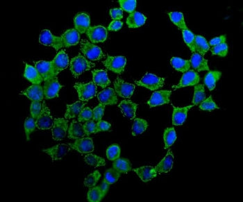 Immunofluorescent staining of FFPE human MCF7 cells with ATP5H antibody (green) and DAPI nuclear stain (blue). HIER: steam section in pH6 citrate buffer for 20 min.