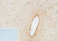 IHC staining of FFPE human brain tissue with GFAP antibody (clone GFAP/9424). Inset: PBS used in place of primary Ab (secondary Ab negative control). HIER: boil tissue sections in pH 9 10mM Tris with 1mM EDTA for 20 min and allow to cool before testing.