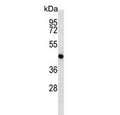 Western blot testing of mouse cerebellum tissue lysate with MEK1 antibody. Predicted molecular weight ~43 kDa.